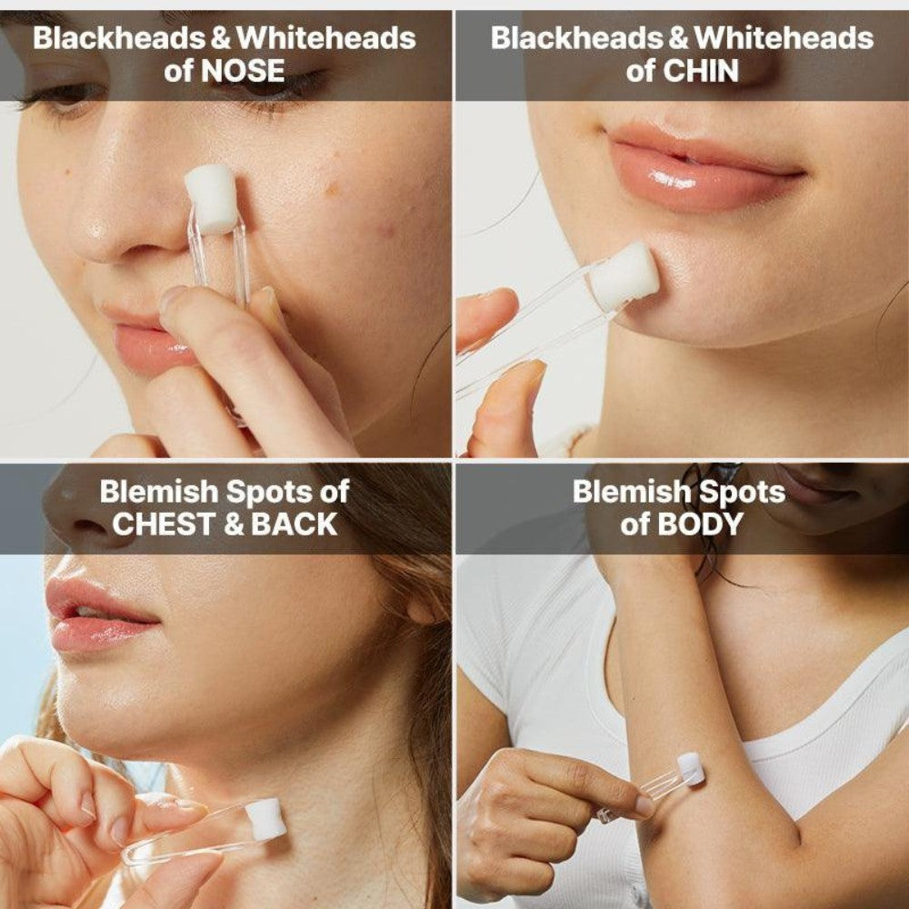 COSRX The AHA 2 BHA 2 Blemish Treatment Serum
