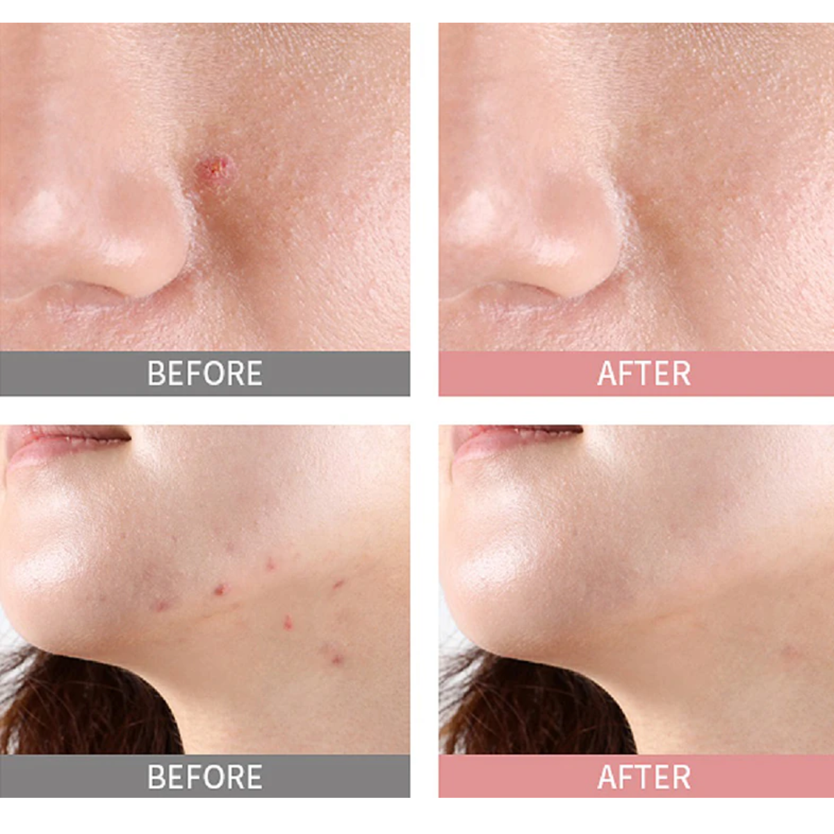 MIZON Good Bye Blemish Pink Spot